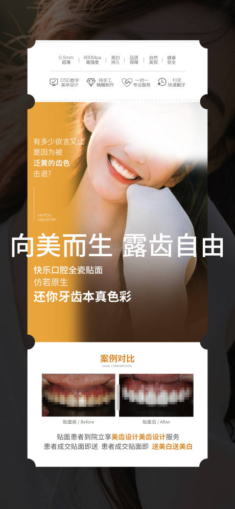 源文件下载【牙齿贴面海报】编号：54100017244492053