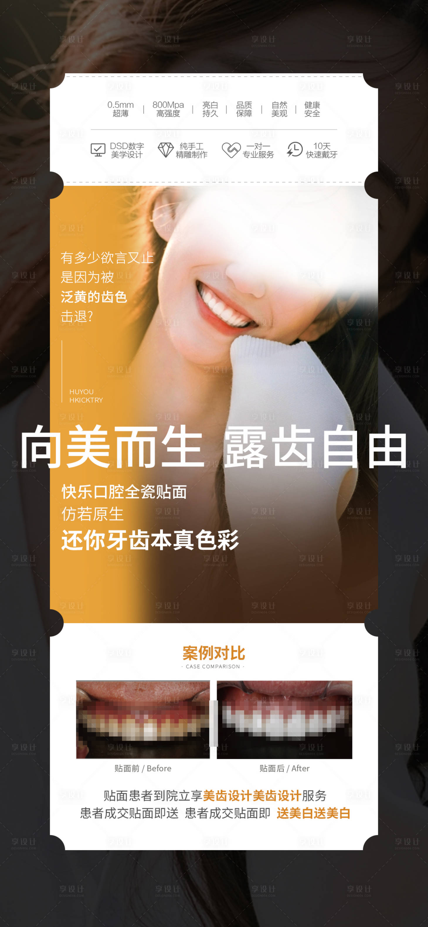 源文件下載【牙齒貼面海報】編號：54100017244492053