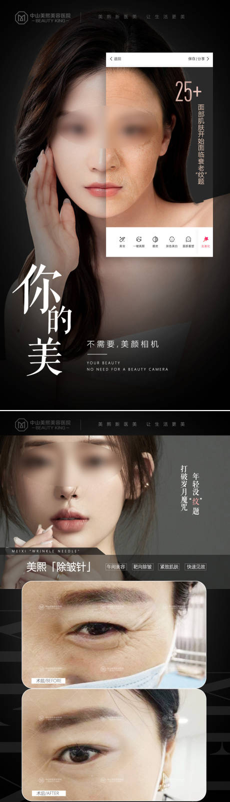 源文件下载【医美除皱系列】编号：66900017730245226