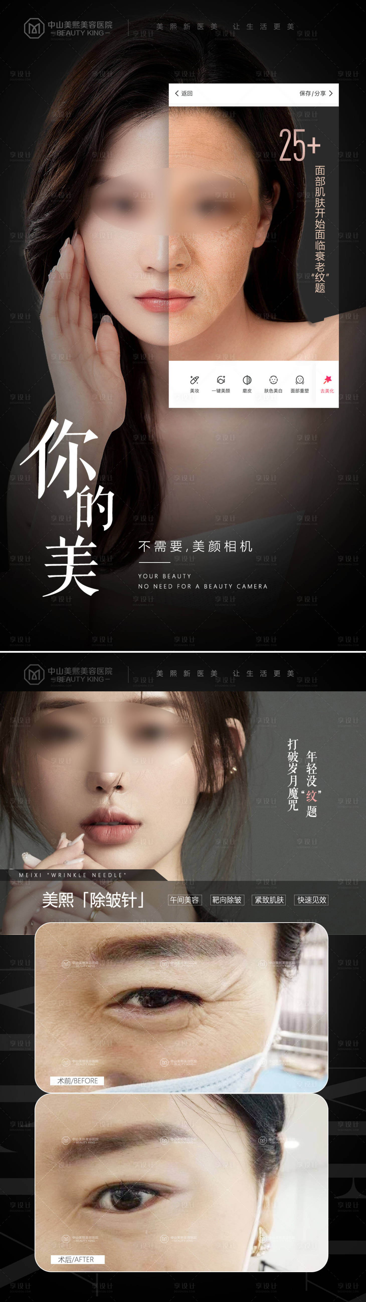 源文件下载【享设计】搜索编号：66900017730245226【医美除皱系列】