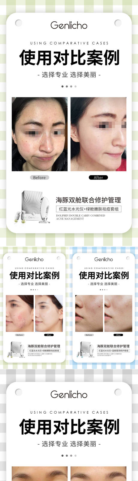 源文件下载【医美案例对比海报】编号：30180017322298475