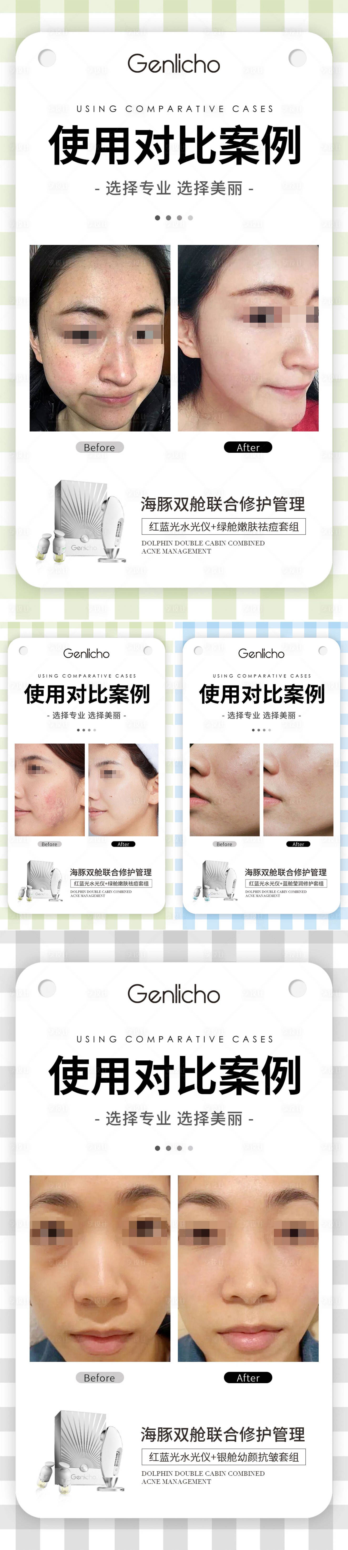 源文件下载【医美案例对比海报】编号：30180017322298475