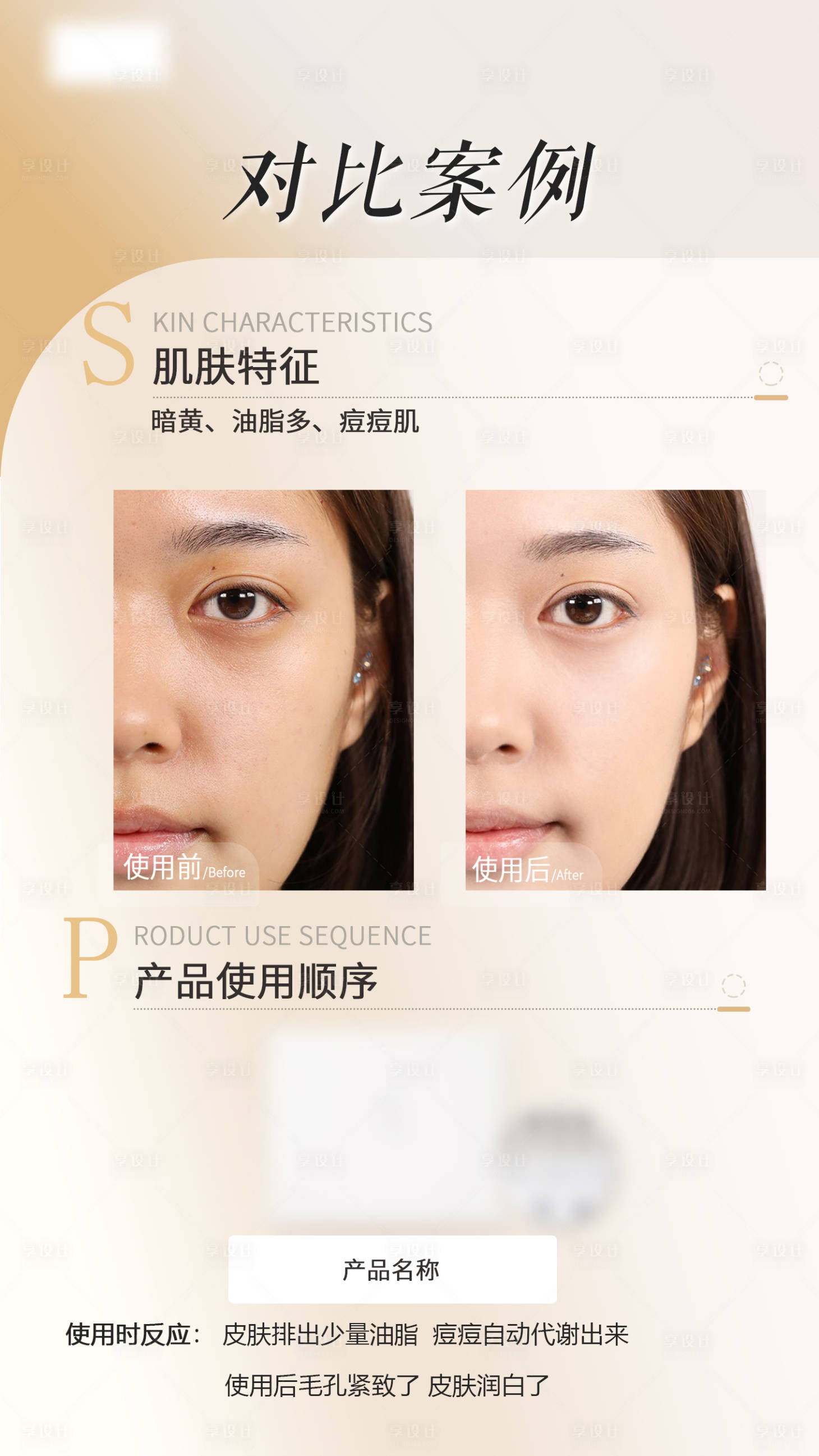 源文件下载【享设计】搜索编号：69500017655823981【医美项目案例对比图】