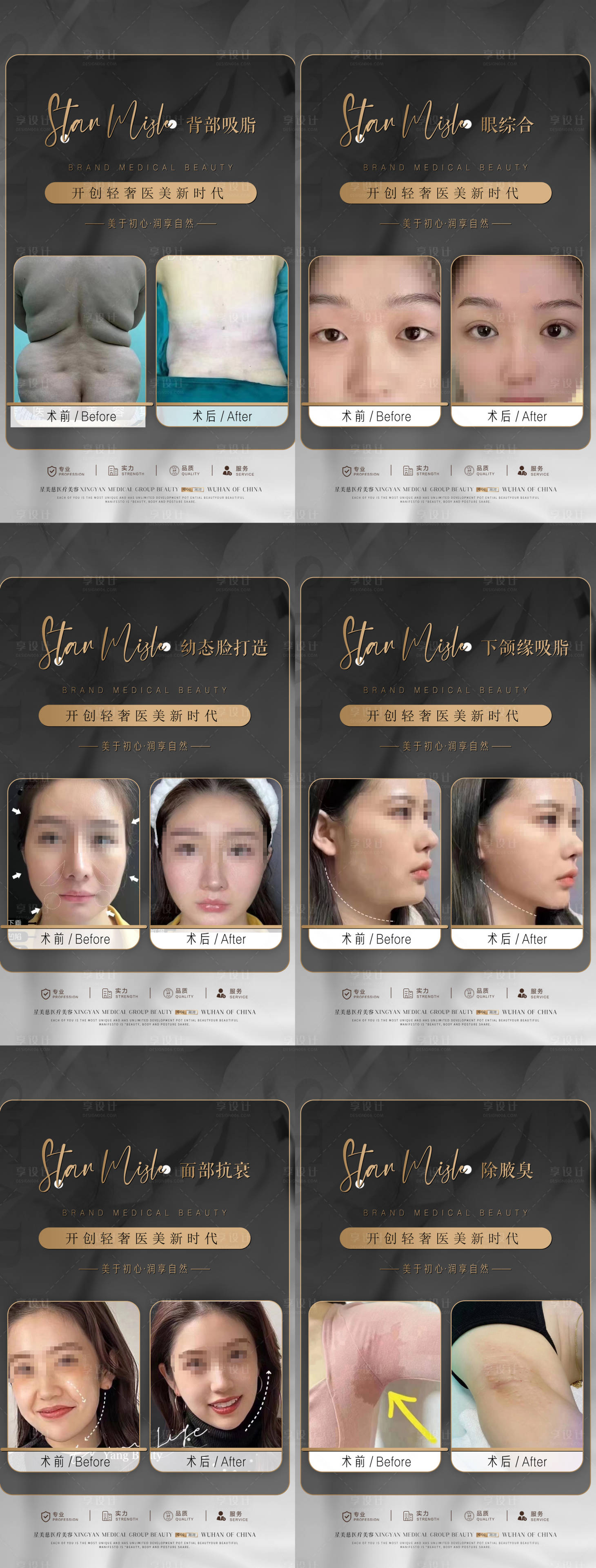 源文件下载【整形案例集合】编号：62150017549247562