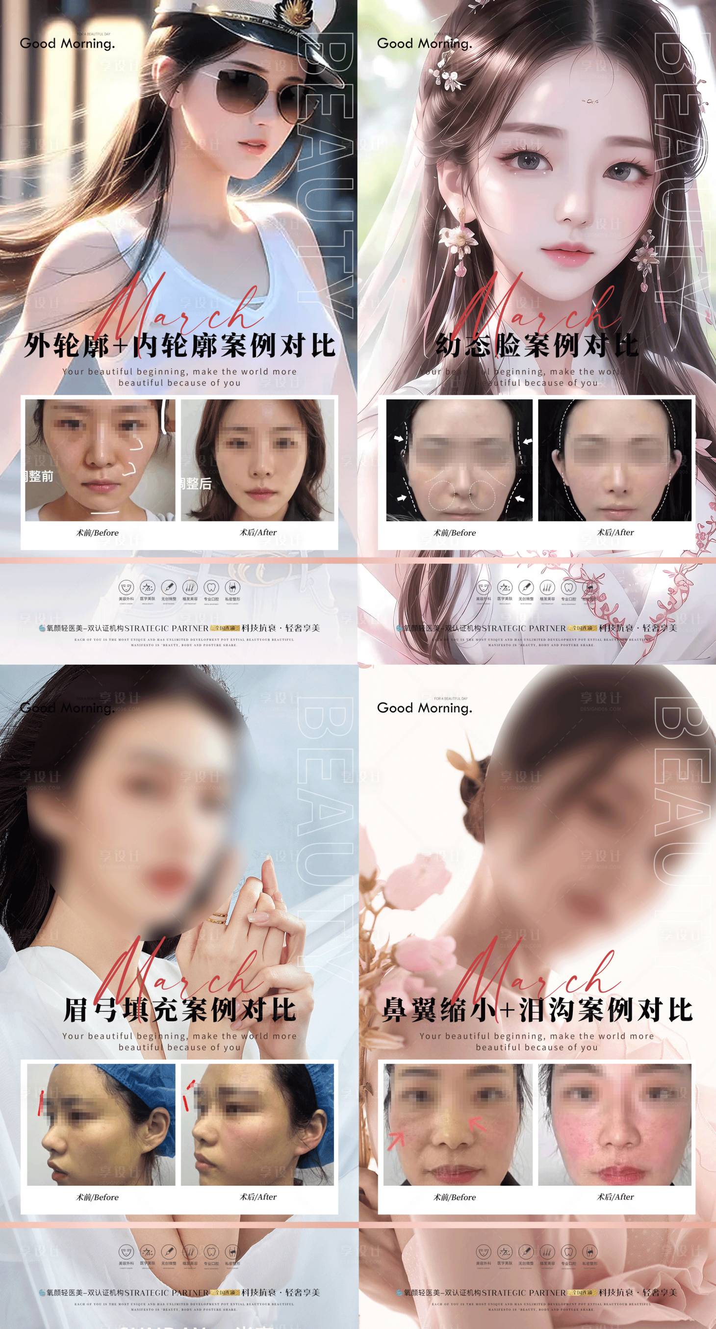 源文件下载【整形案例合集案例】编号：45740017559192266