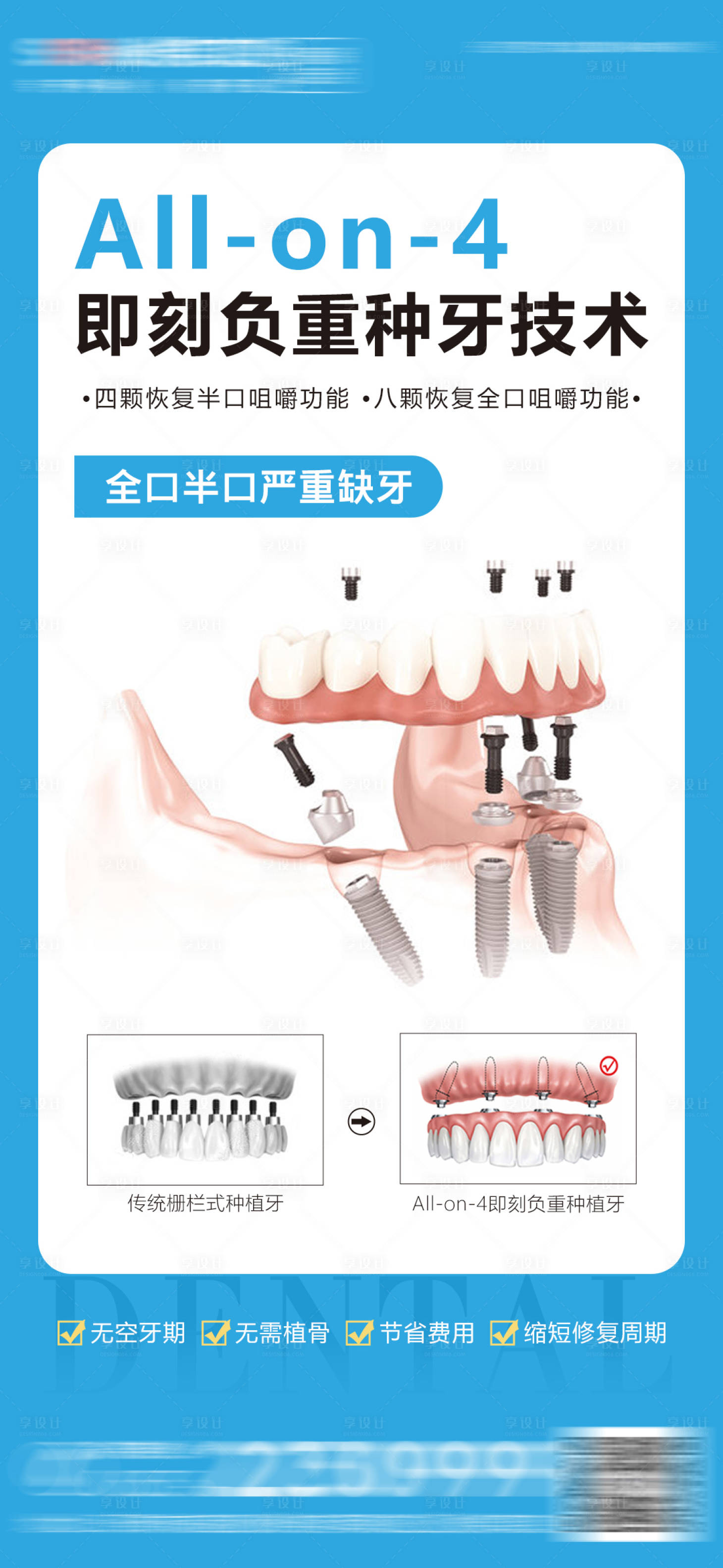 源文件下載【享設計】搜索編號：22590017329271214【醫美口腔種植牙海報】