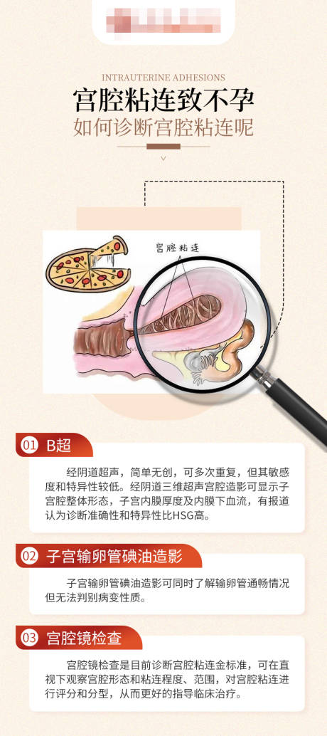 源文件下載【婦科海報】編號：15990017253977006