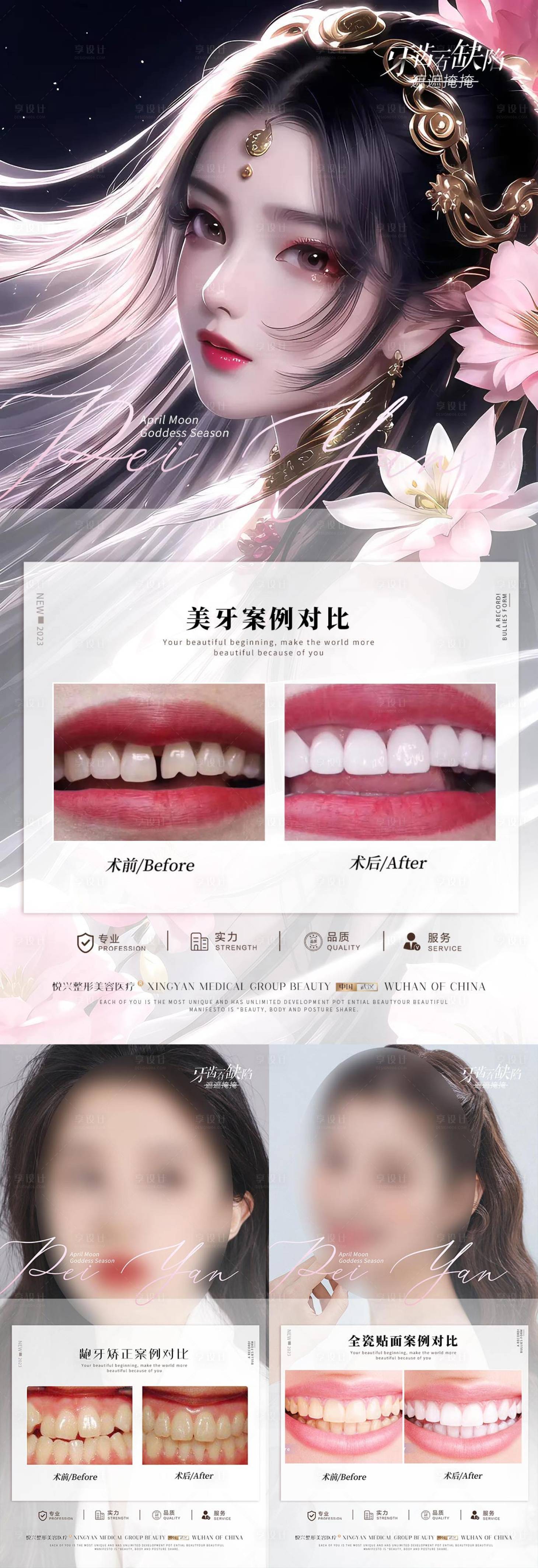 源文件下載【口腔案例系列海報】編號：26180017616763802