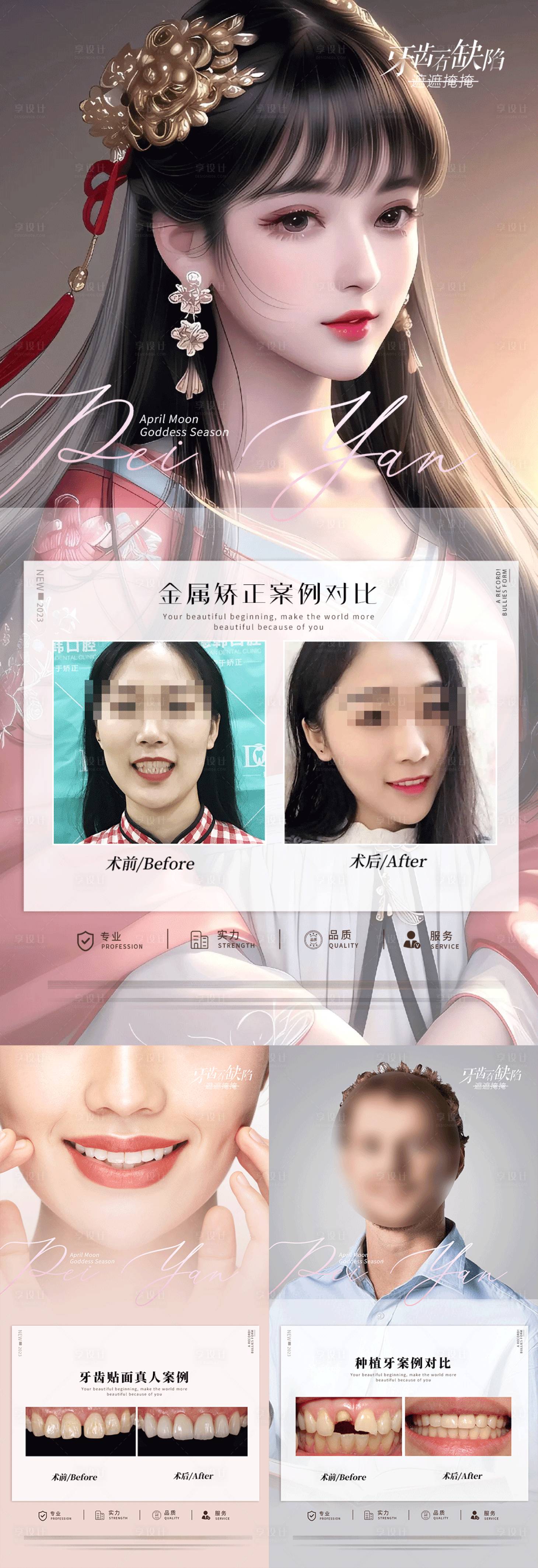源文件下载【享设计】搜索编号：92890017463823855【口腔案例宣传海报 】