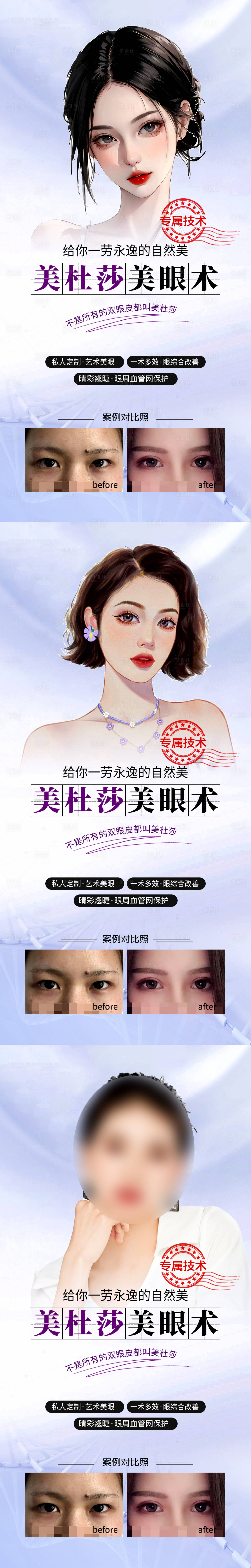 源文件下载【医美双眼皮案例海报】编号：25310017371564685
