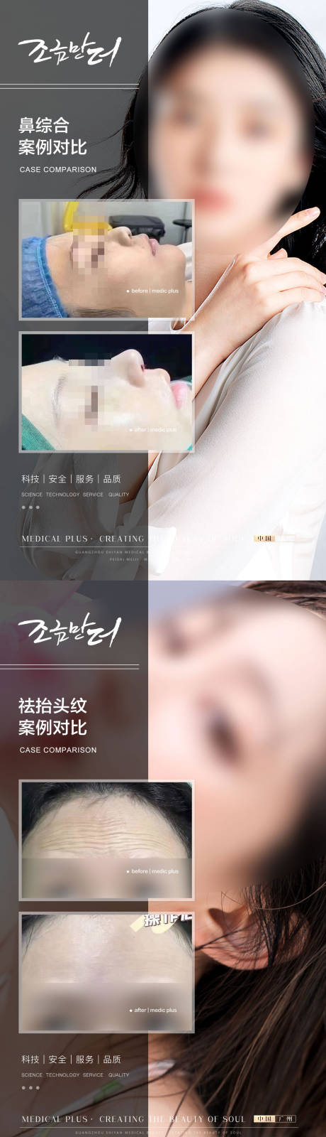 源文件下载【医美案例】编号：85640017314879167