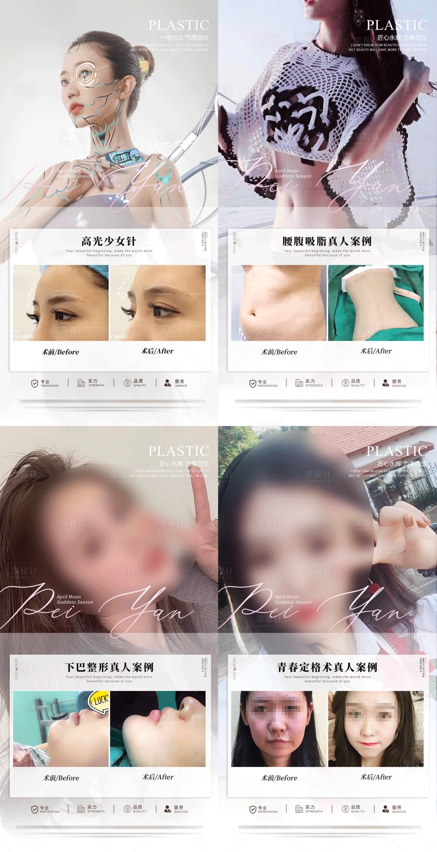 源文件下載【享設(shè)計】搜索編號：82380017499304664【整形案例宣傳海報】