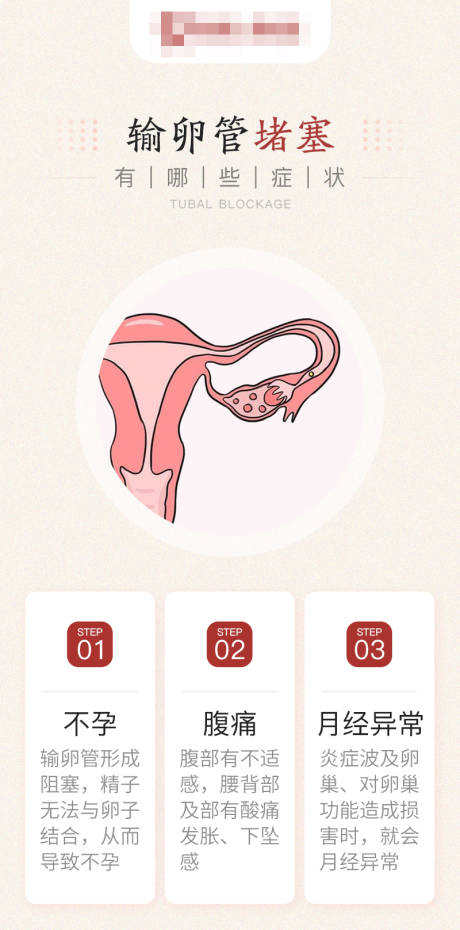 编号：20230605083038084【享设计】源文件下载-不孕科普输卵管堵塞有哪些症状海报