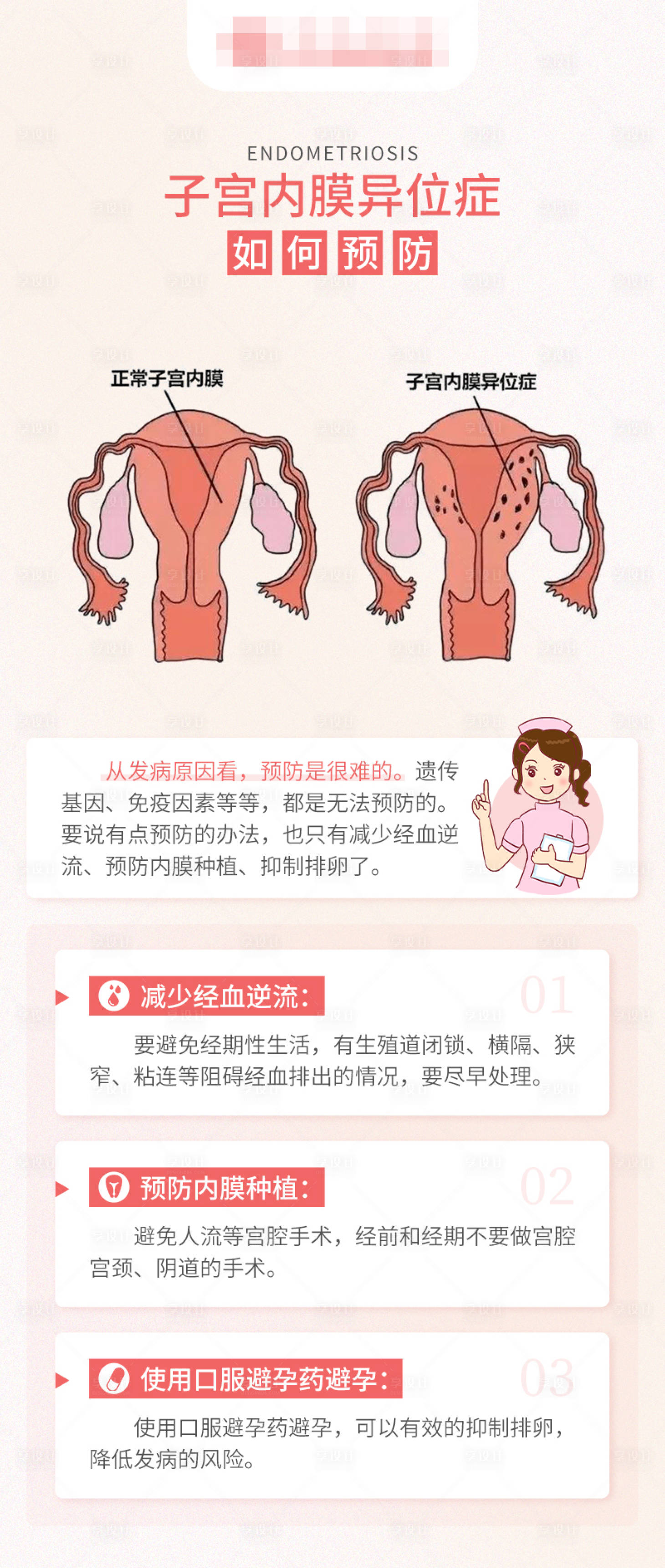 源文件下载【子宫内膜异位症不孕科普长图海报】编号：64260017125273958