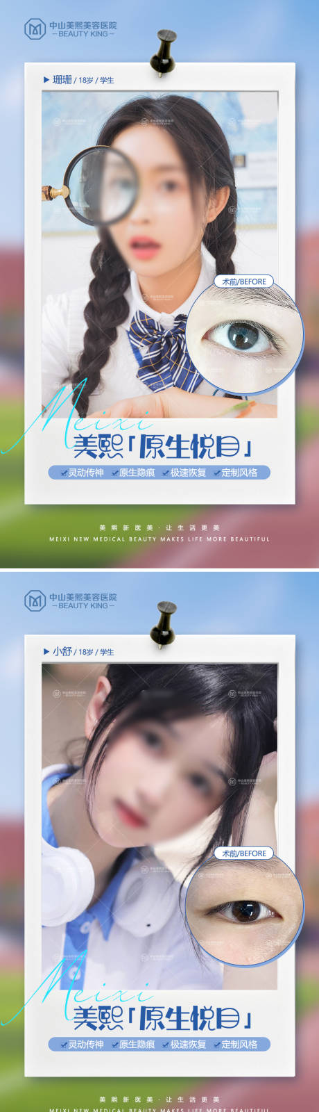 源文件下载【毕业季双眼皮案例海报】编号：56010017627799886