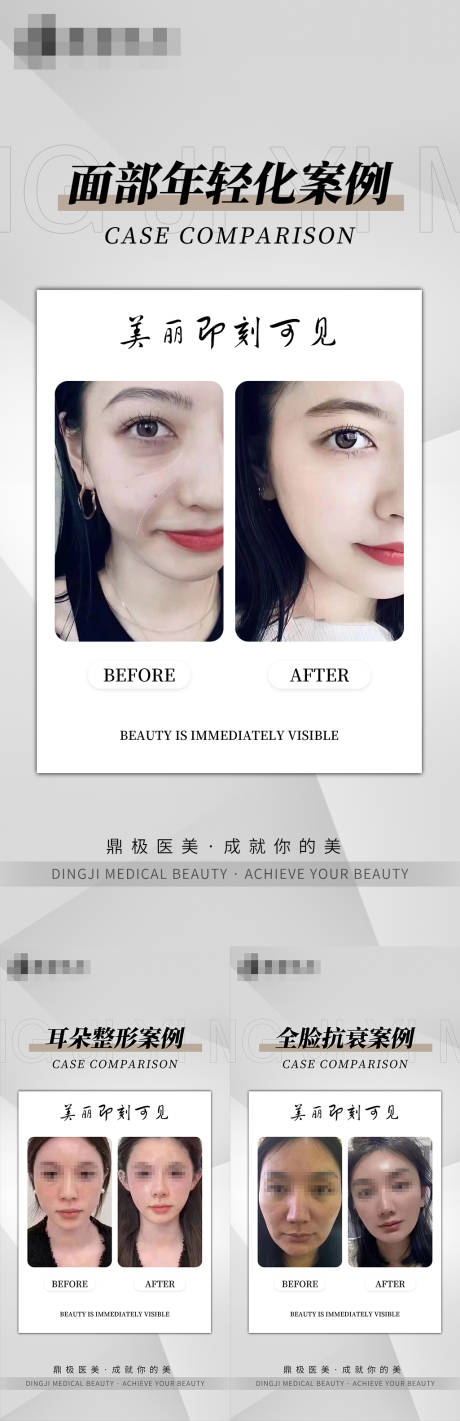 源文件下载【医美简约案例海报】编号：97660017568594177
