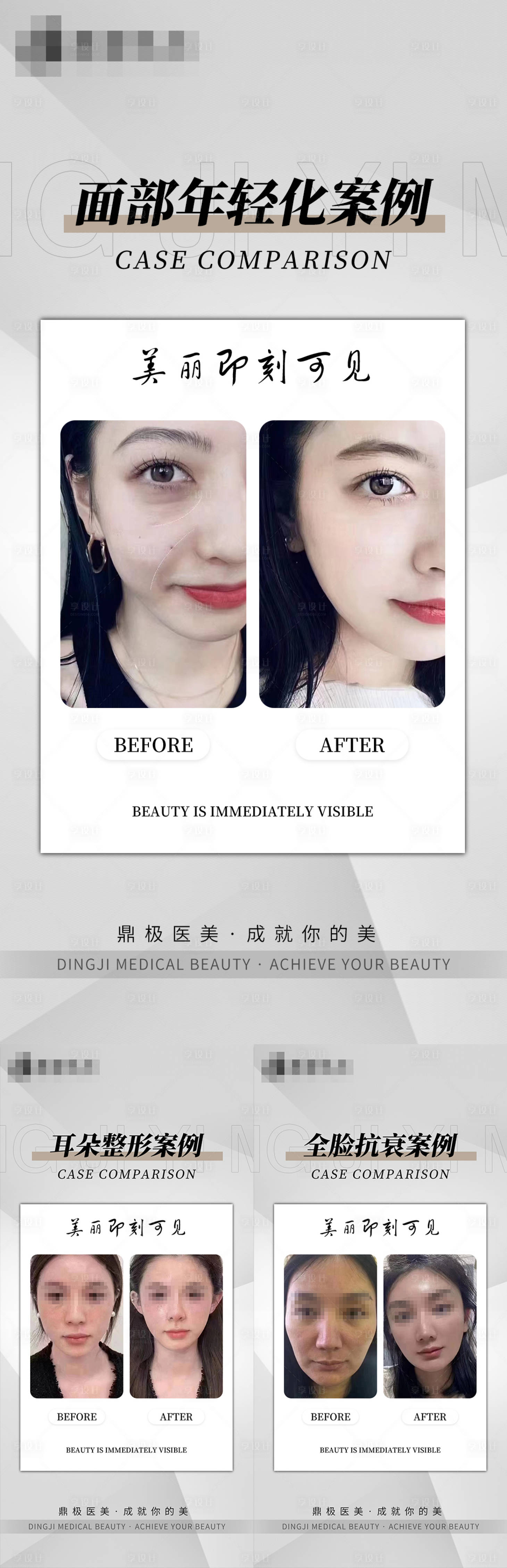 源文件下载【享设计】搜索编号：97660017568594177【医美简约案例海报】