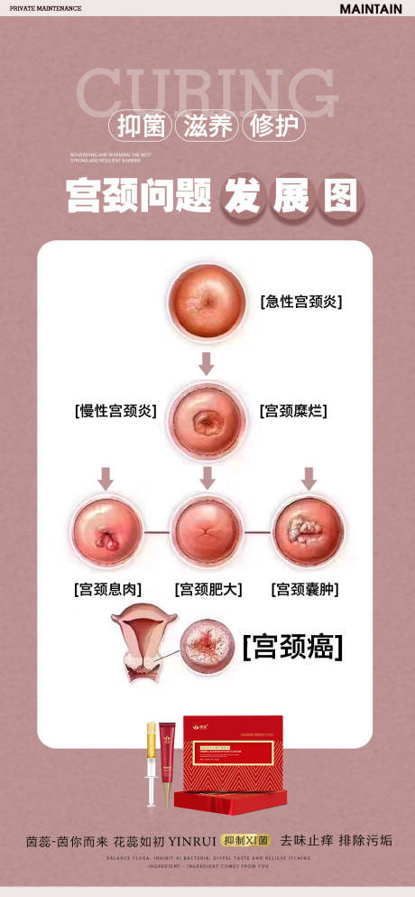 源文件下载【宫颈示意图】编号：48340017544924486