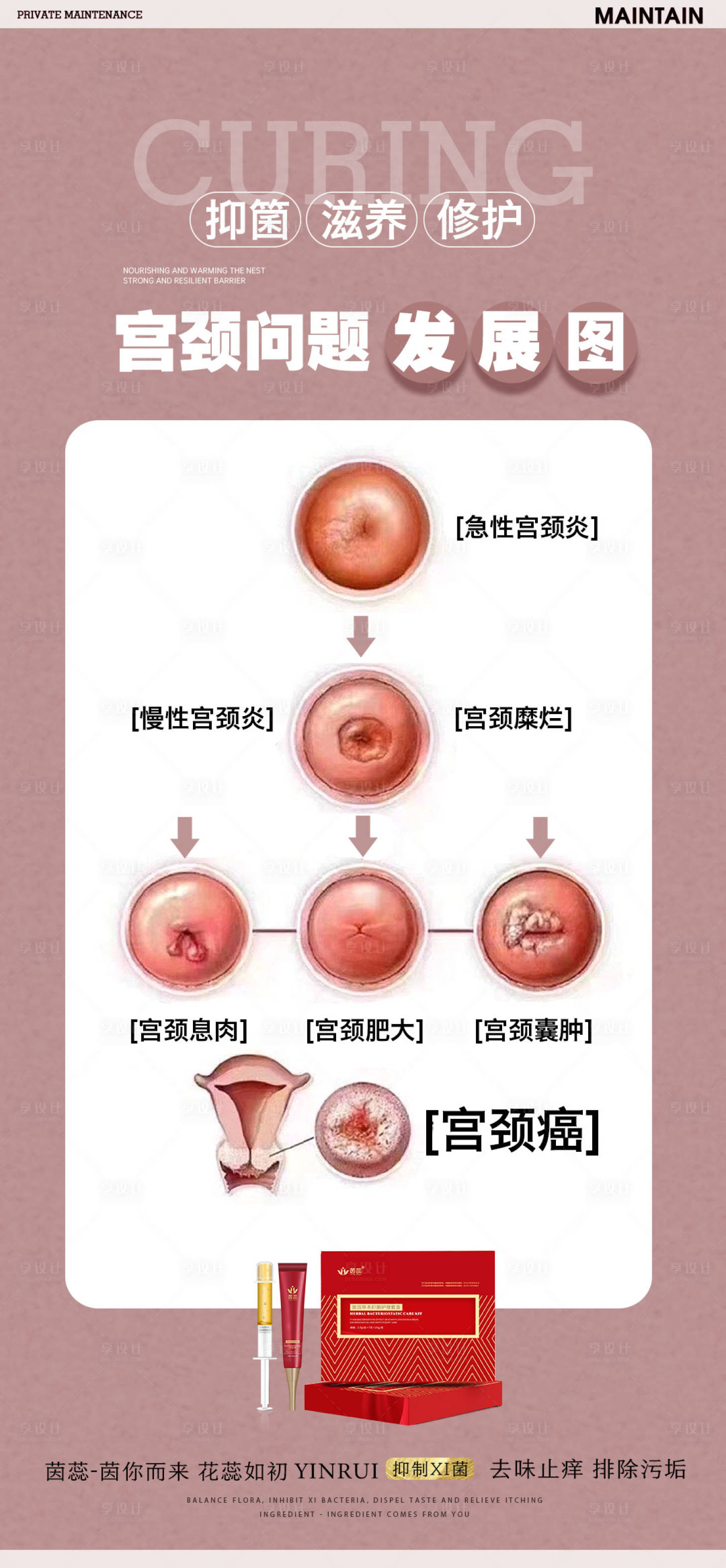 源文件下載【享設計】搜索編號：48340017544924486【宮頸示意圖】