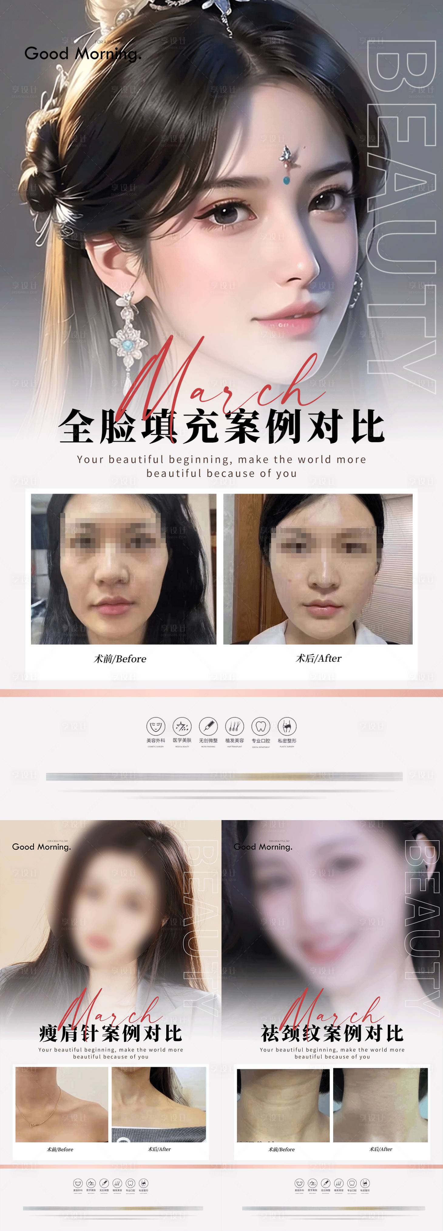 源文件下載【醫美案例海報】編號：95310017463846311