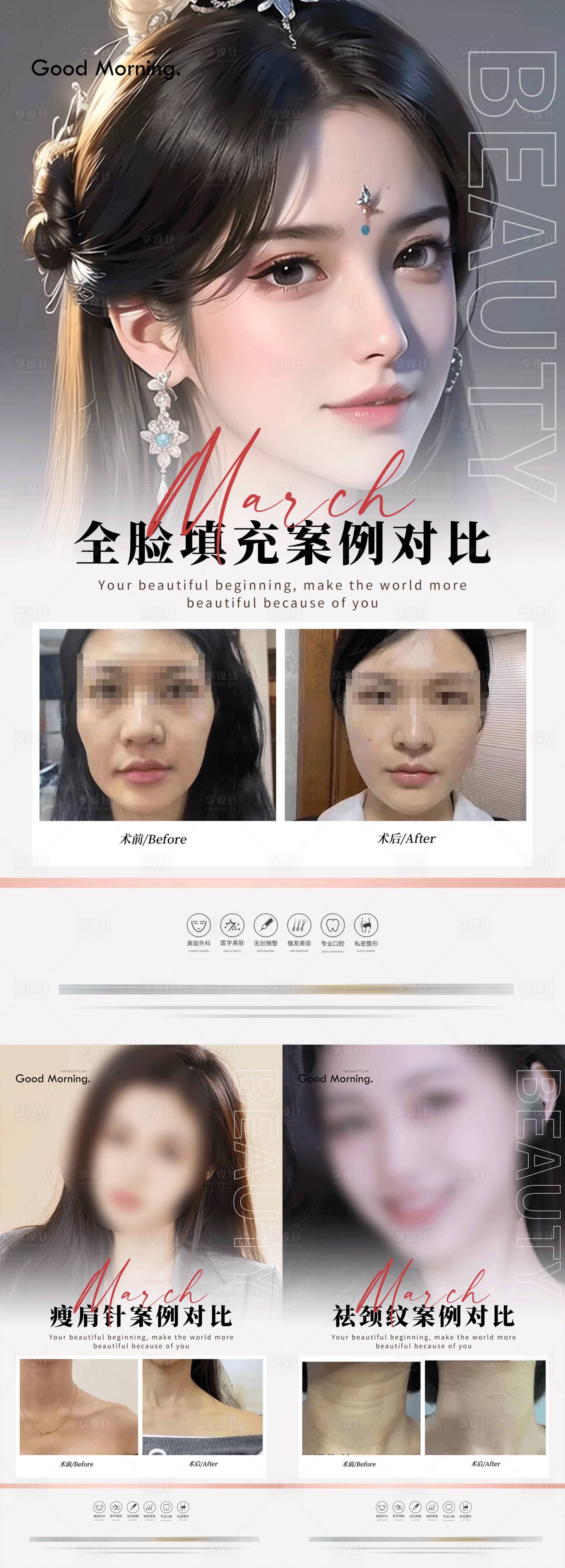 编号：20230618135909529【享设计】源文件下载-医美案例海报