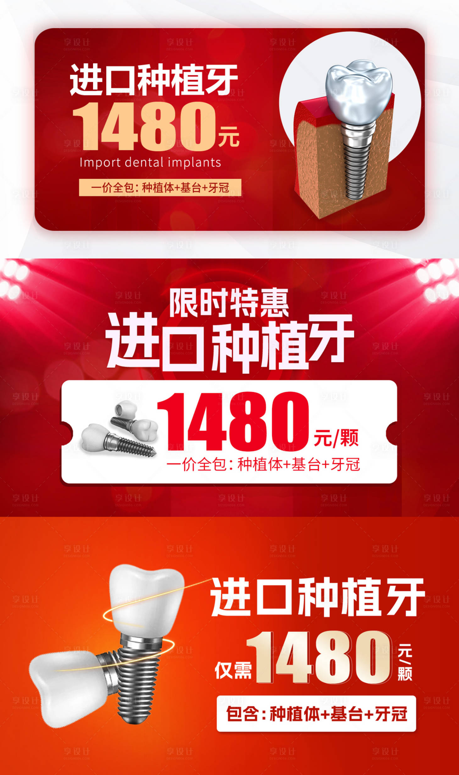 源文件下载【种植牙banner】编号：41230017579019077
