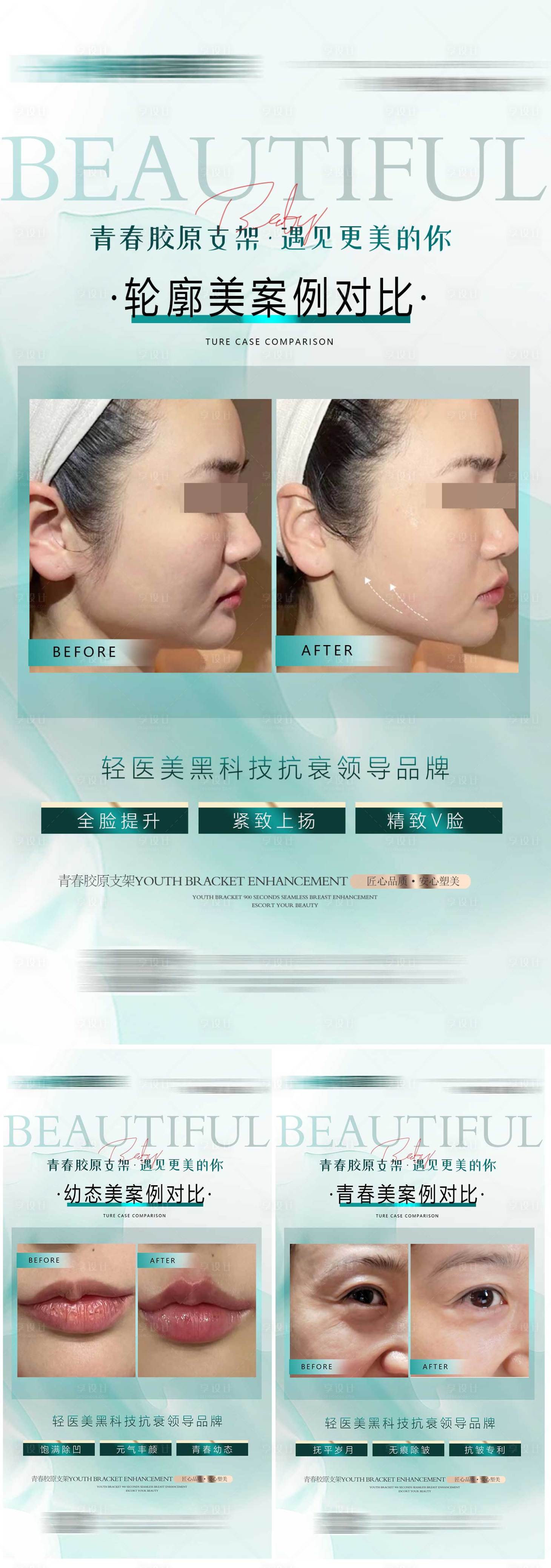 源文件下載【享設計】搜索編號：71250017443479805【醫美面部品項對比圖系列】