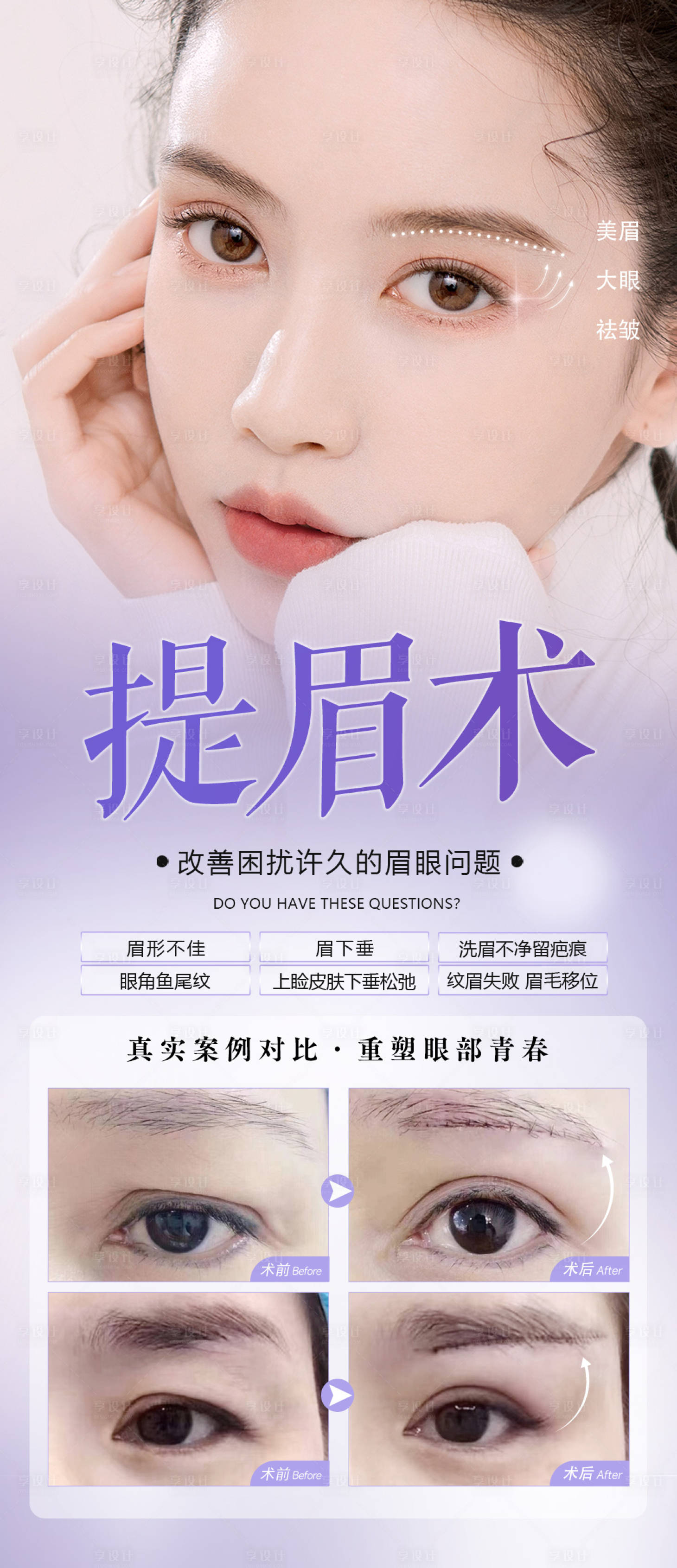 源文件下载【享设计】搜索编号：43300017452797327【提眉眼部医美真人整形案例海报】