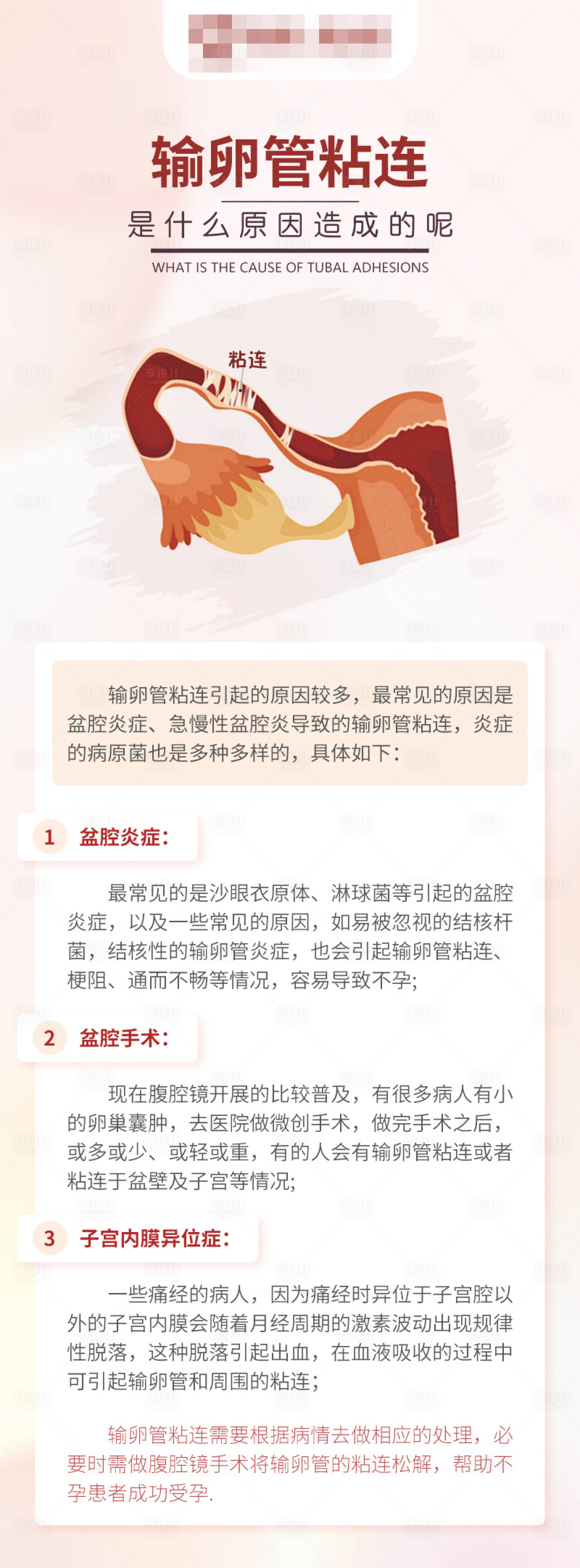 源文件下載【享設計】搜索編號：92710017363574988【輸卵管粘連不孕科普海報】