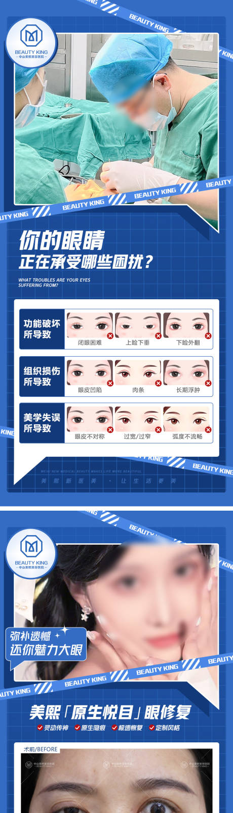 源文件下載【眼修復(fù)案例系列】編號(hào)：67710017628187945