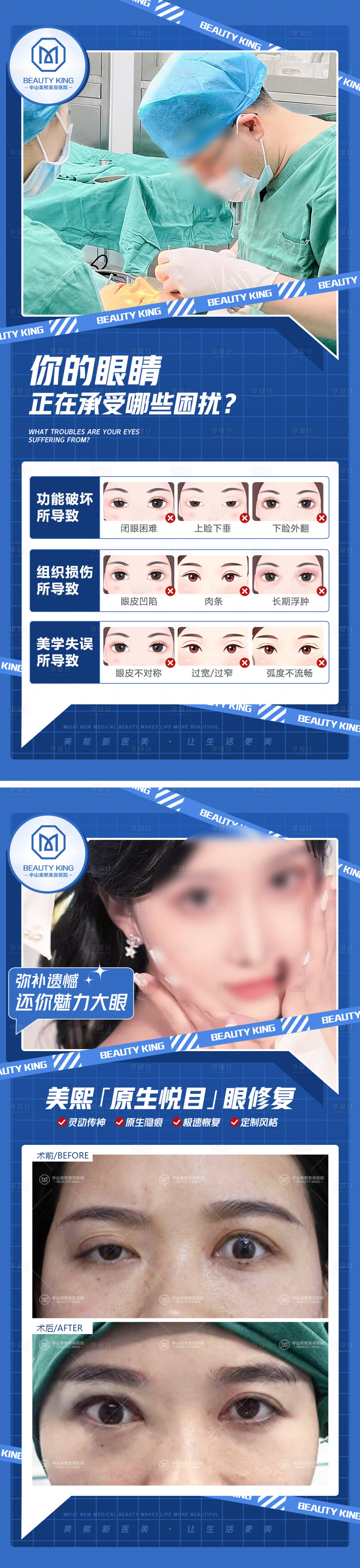 源文件下载【享设计】搜索编号：67710017628187945【眼修复案例系列】