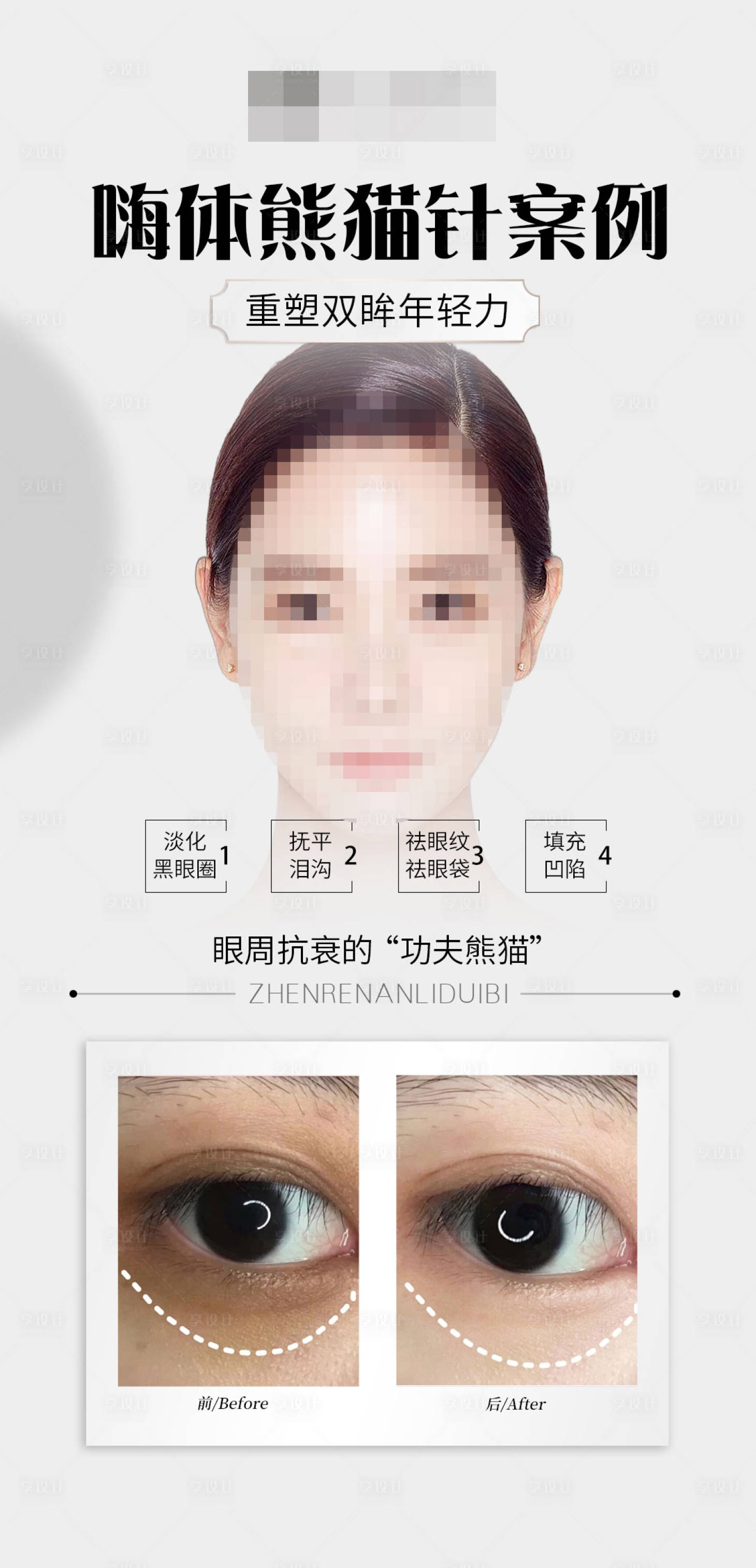 源文件下載【嗨體熊貓案例對比海報】編號：96500017067471953