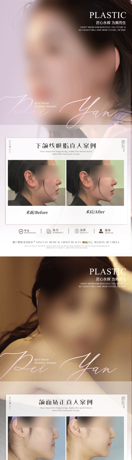 源文件下载【整形真人案例分享集】编号：97760017243195600