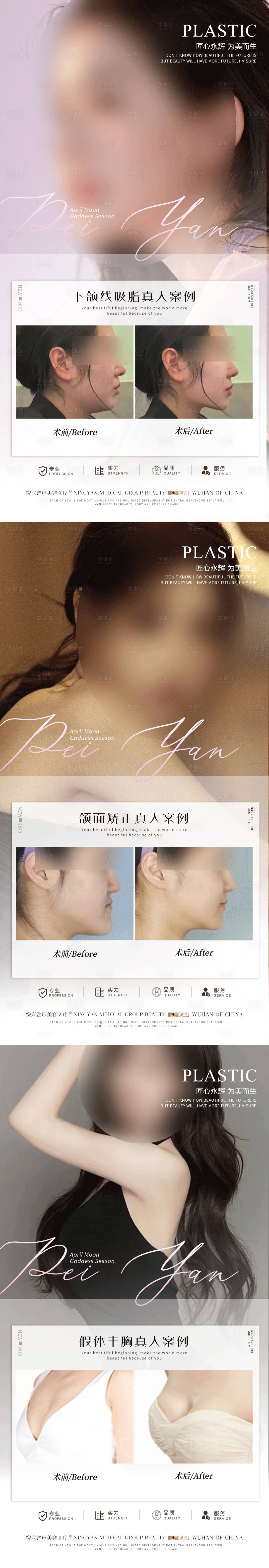 源文件下载【整形真人案例分享集】编号：97760017243195600