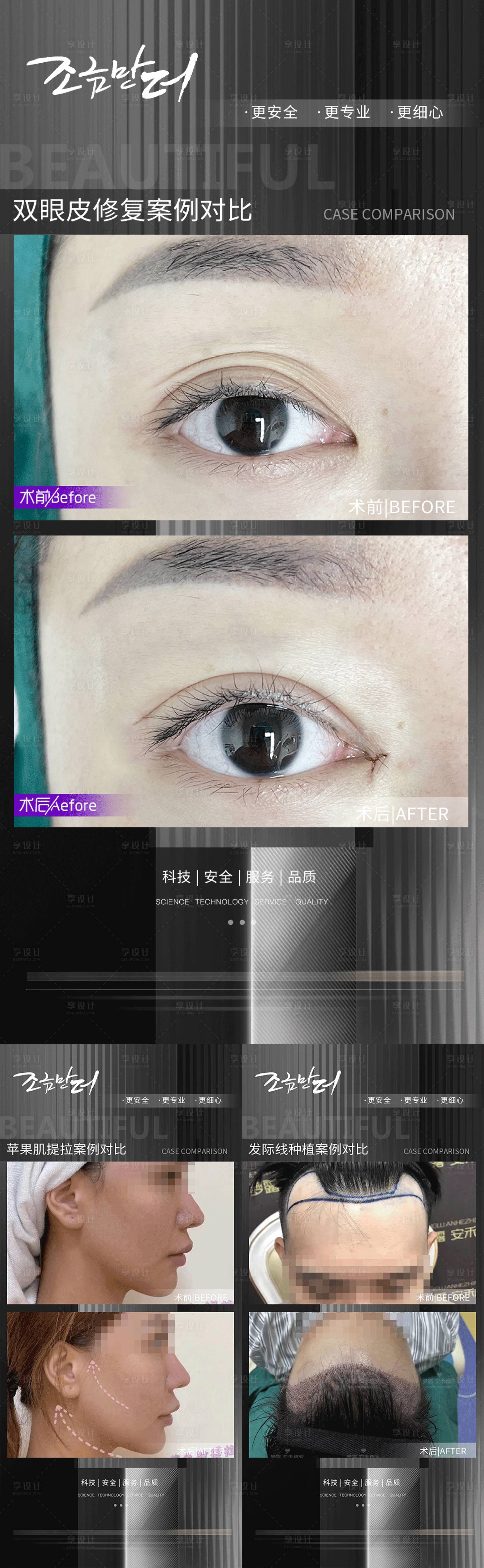源文件下载【整形植发案例】编号：34500017352467609