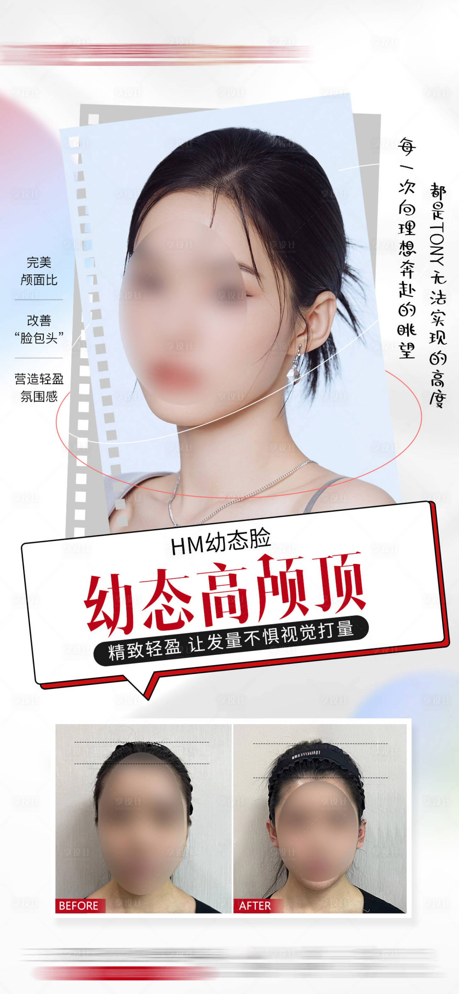 源文件下載【享設(shè)計】搜索編號：71780017453966108【醫(yī)美案例對比海報】