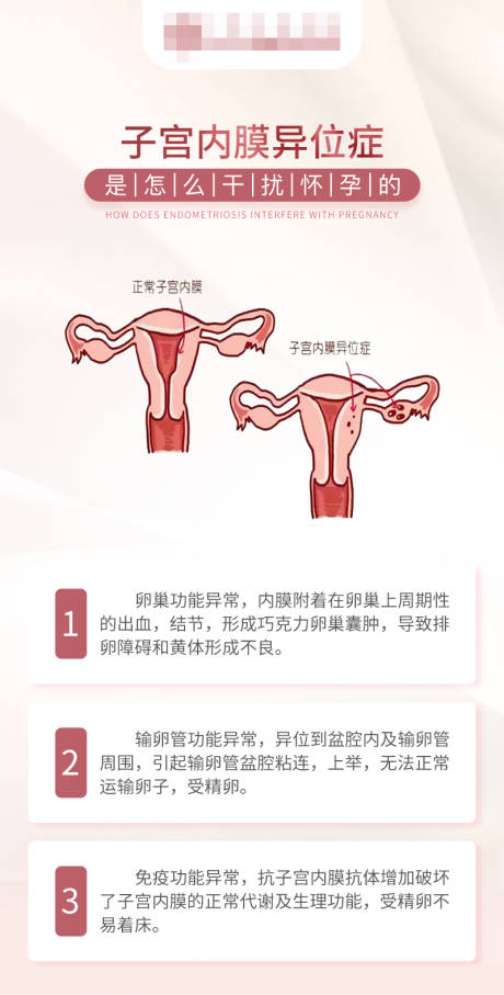 子宫内膜异位症海报