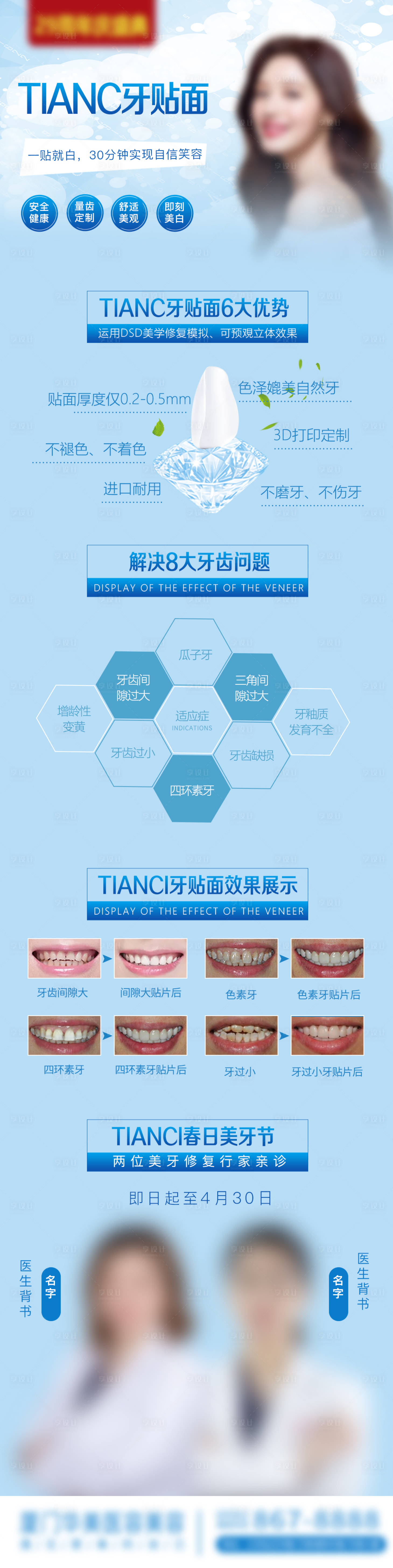 源文件下載【享設計】搜索編號：32090017347605915【牙貼面項目長圖】