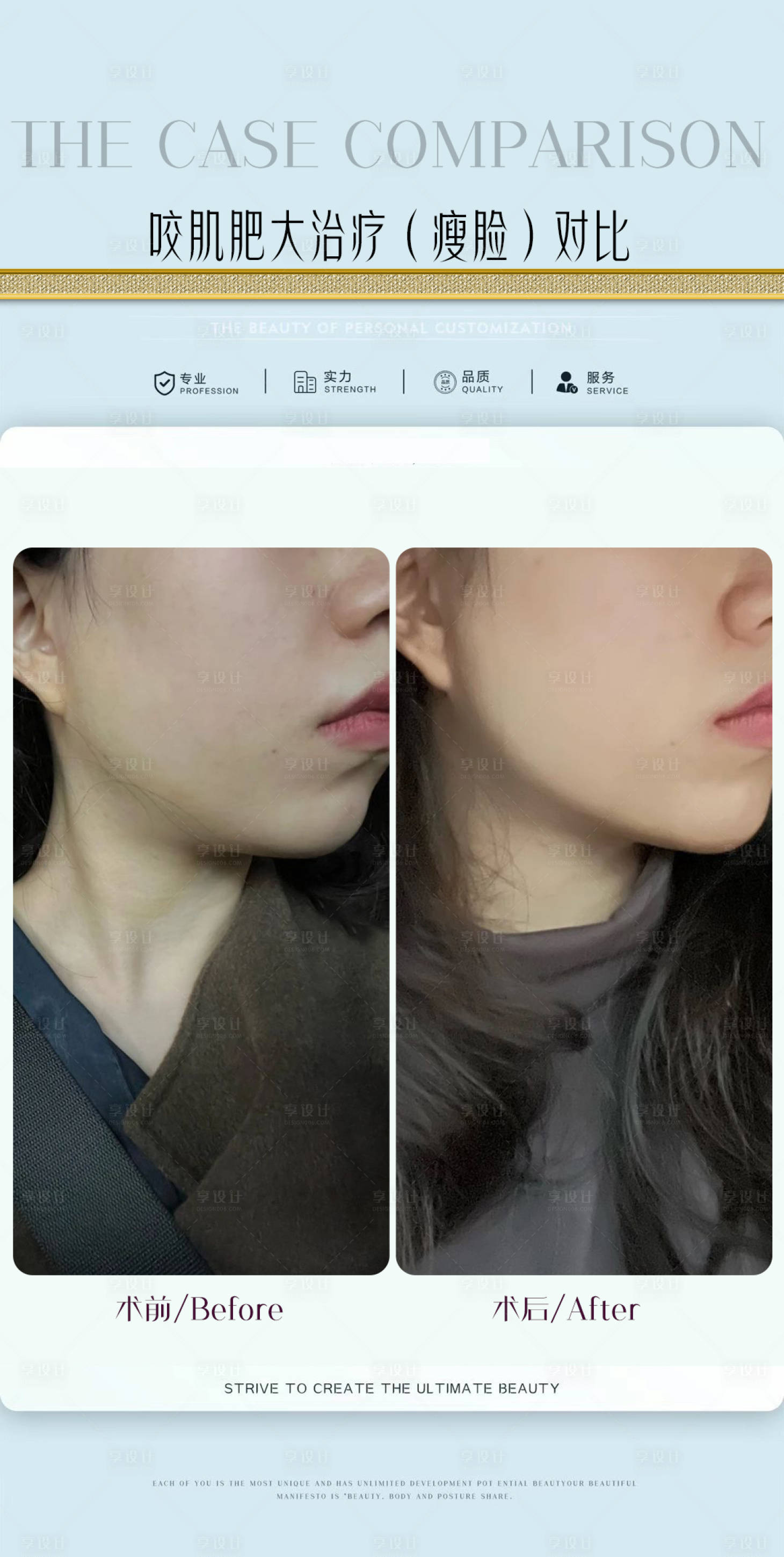 源文件下載【享設計】搜索編號：77080017711271888【咬肌肥大治療海報】