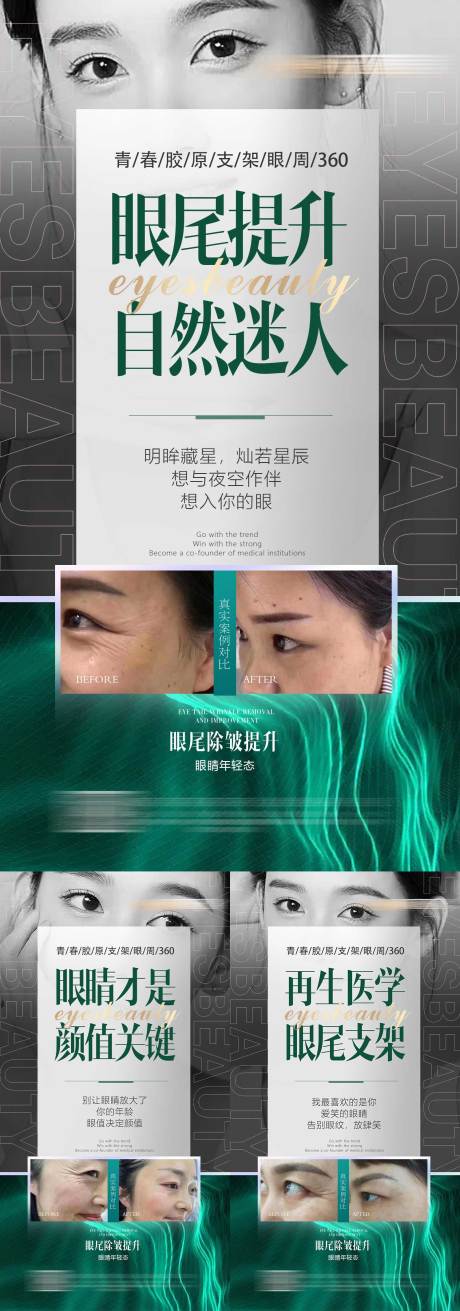 源文件下载【医美眼部品项宣传系列】编号：17090017386161929