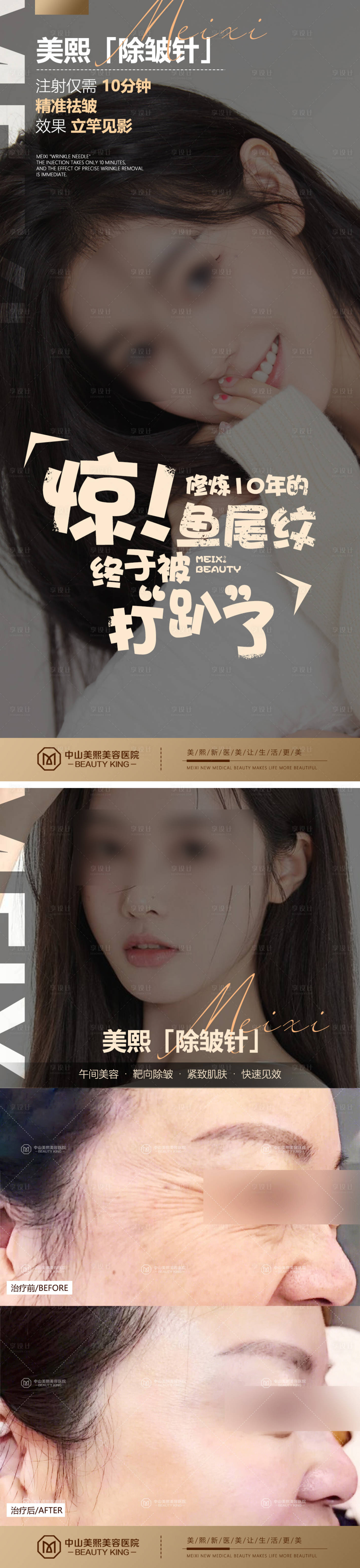 源文件下載【享設計】搜索編號：43540017730256875【醫美除皺針海報】