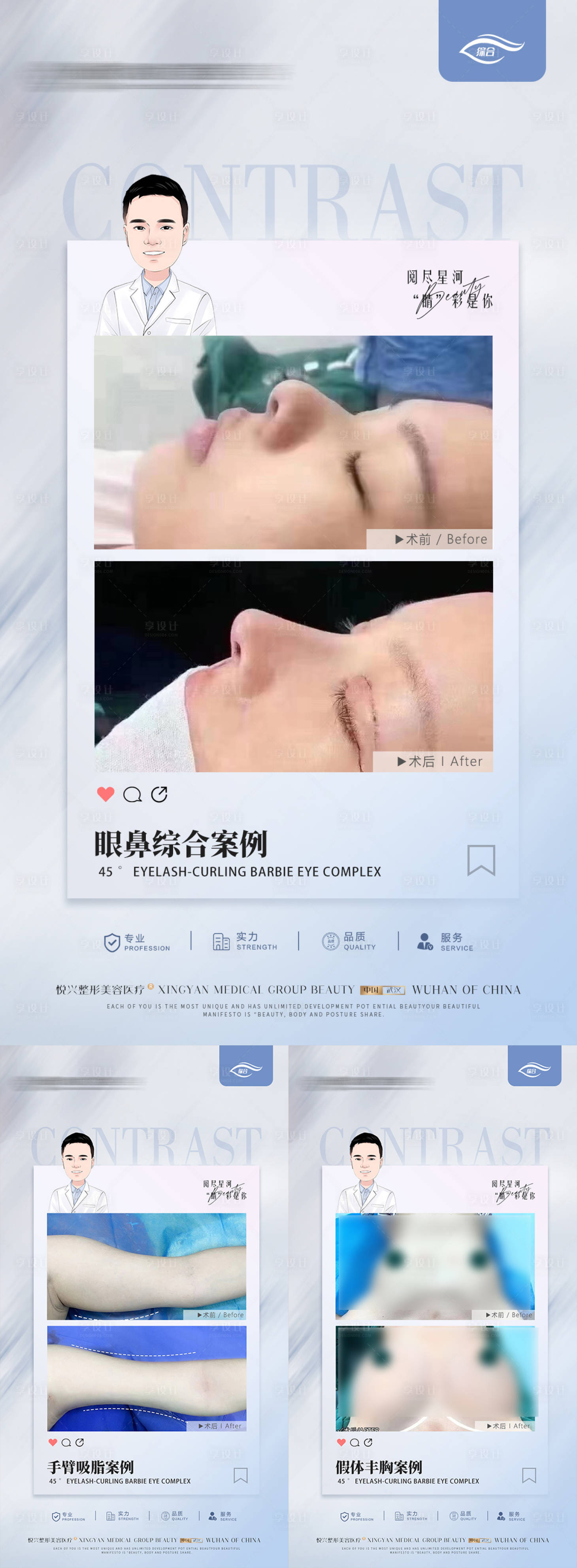 源文件下载【整形案例合集】编号：29760017549479290