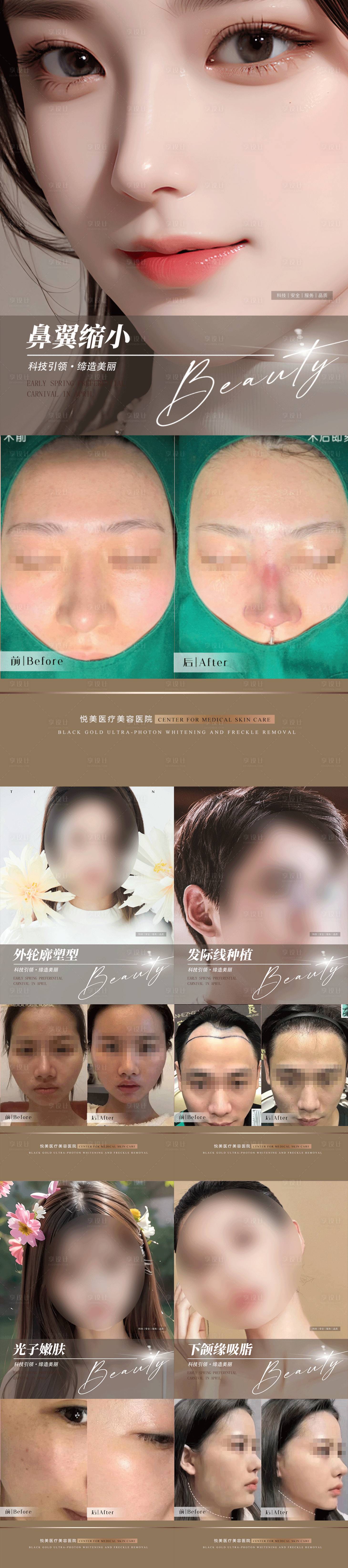 源文件下載【享設計】搜索編號：86720017690303500【整形植發(fā)案例集】
