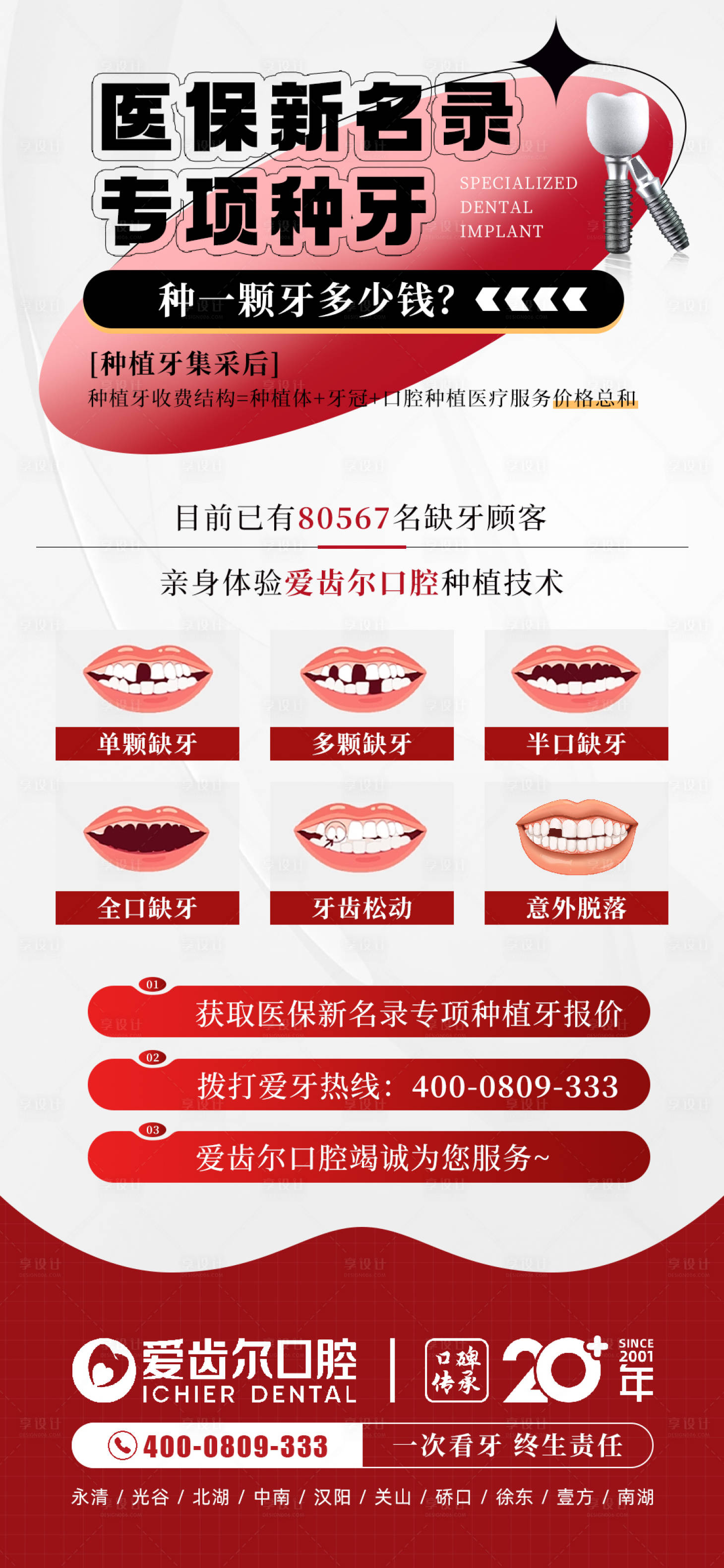源文件下載【享設計】搜索編號：86530017167977097【種植牙活動長圖】