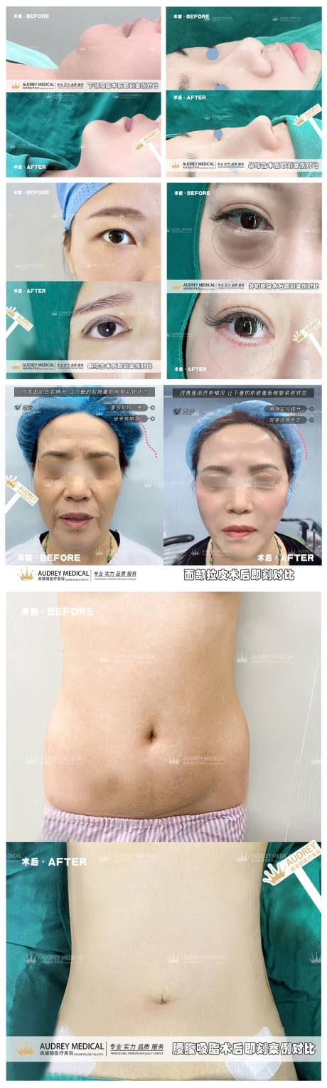 源文件下载【医美整形案例分享海报】编号：12730017264489502