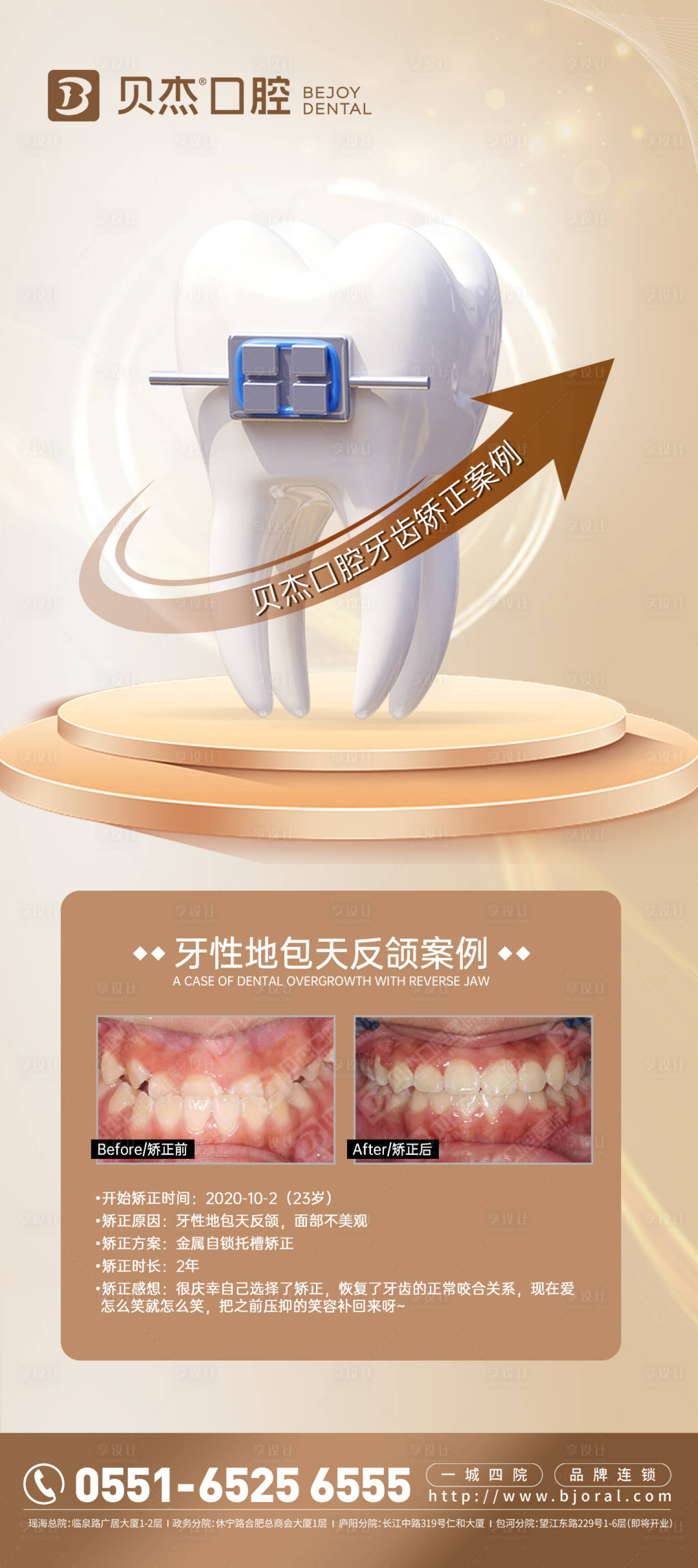 源文件下載【享設(shè)計(jì)】搜索編號：89070017317243151【口腔金屬矯正海報(bào)】