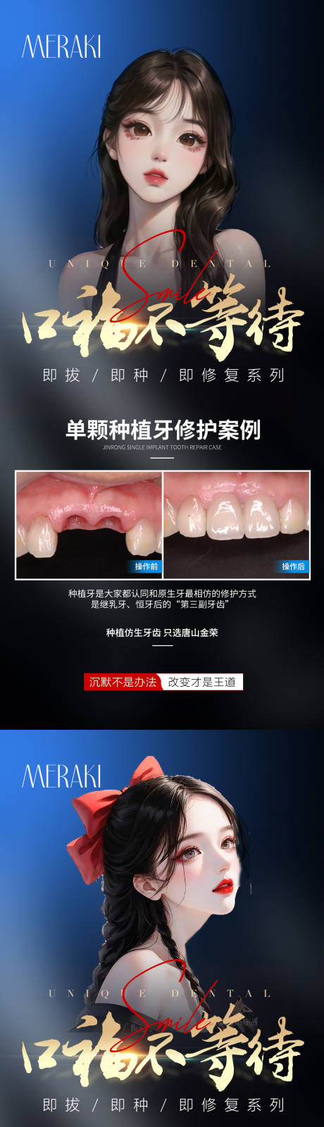 编号：20230626140905090【享设计】源文件下载-医美牙齿种植系列海报