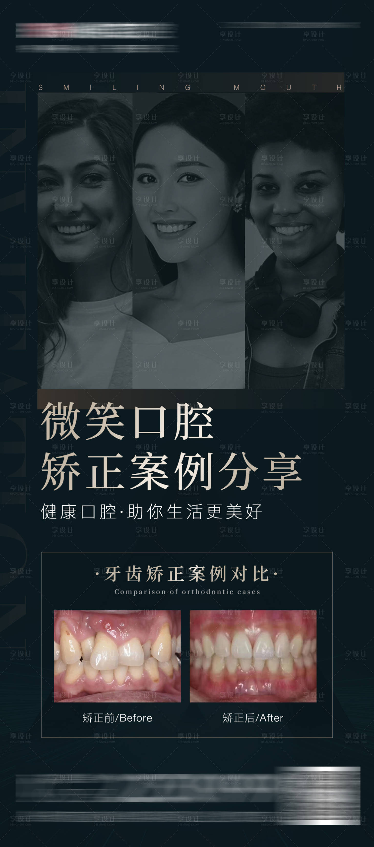 源文件下载【享设计】搜索编号：98630017369662217【医美口腔矫正案例对比海报】