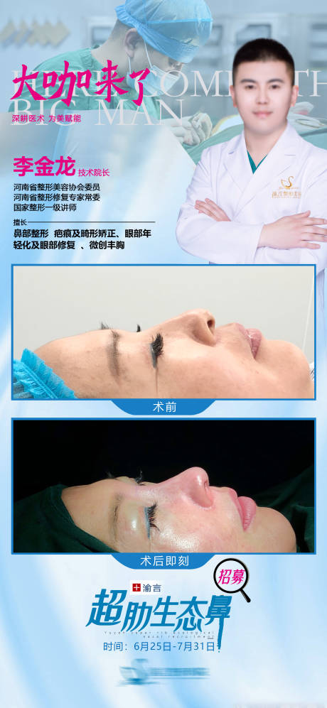 源文件下载【医美鼻子招募活动海报】编号：26960017132152234