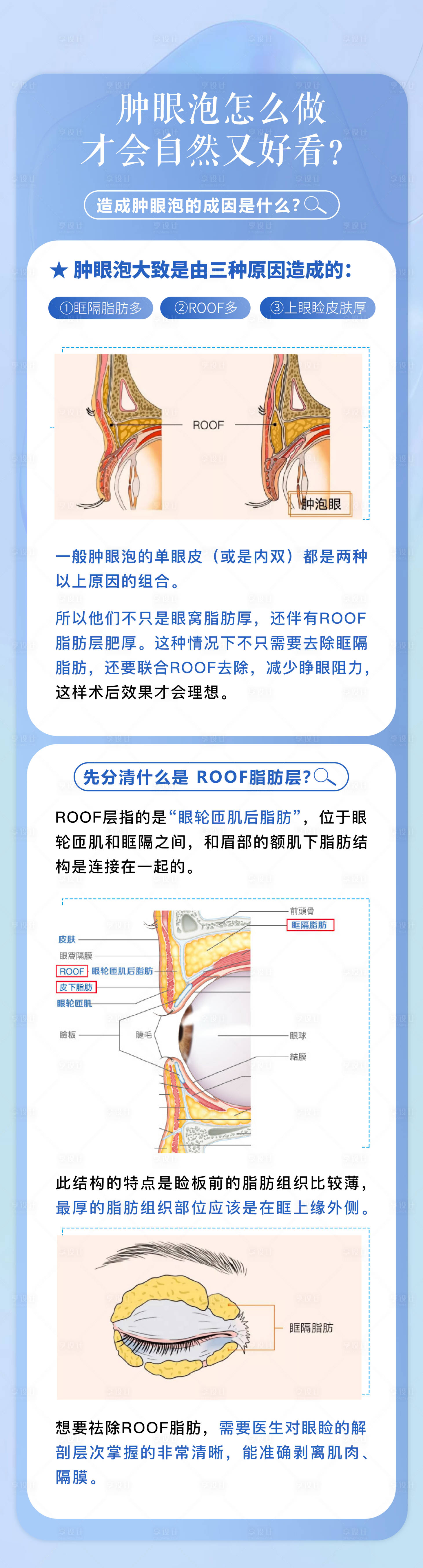 源文件下载【肿眼泡科普】编号：47570017208075075